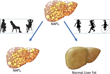 نشانه های کبد چرب, تشخیص کبد چرب در کودکان, کنترل کبد چرب در کودکان
