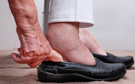 علائم کلیه ناسالم,علائم کم کاری کلیه