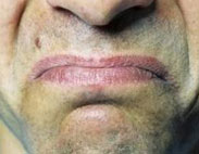 علائم کلیه ناسالم,علائم کم کاری کلیه