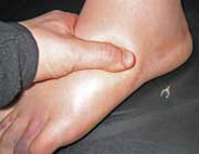 علائم کلیه ناسالم,علائم کم کاری کلیه