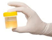 علائم کلیه ناسالم,علائم کم کاری کلیه