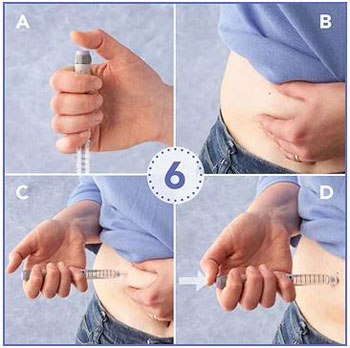 نحوه تزریق انسولین,آموزش تزریق انسولین
