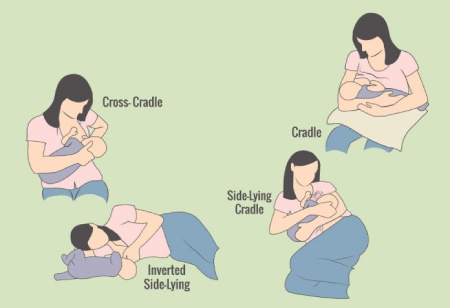 درد شانه و گردن در دوران شیردهی,علل درد شانه و گردن در دوران شیردهی,پوزیشن شیردهی به نوزاد