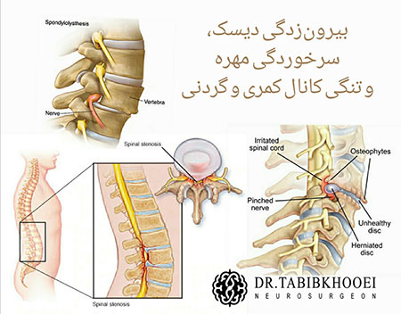 جراحی مغز و اعصاب,جراح مغز و اعصاب در ایران