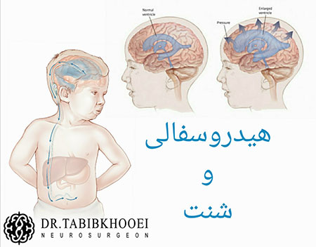 جراحی مغز و اعصاب,جراح مغز و اعصاب در ایران