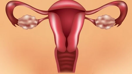 علائم تنبلی تخمدان در دختر, دلیل تنبلی تخمدان