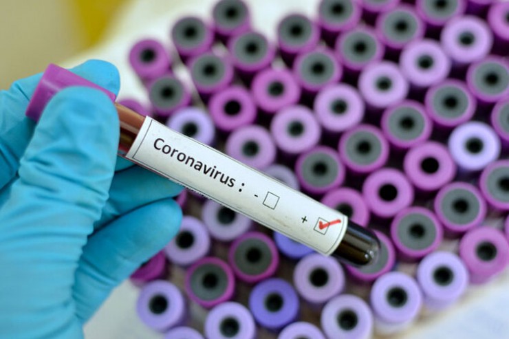 نتایج آزمایش اولیه دو مورد مشکوک ابتلا به کروناویروس در قم، مثبت گزارش شد