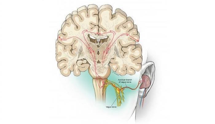 تحریک الکتریکی عصب واگ از مسیر گوش بیرونی