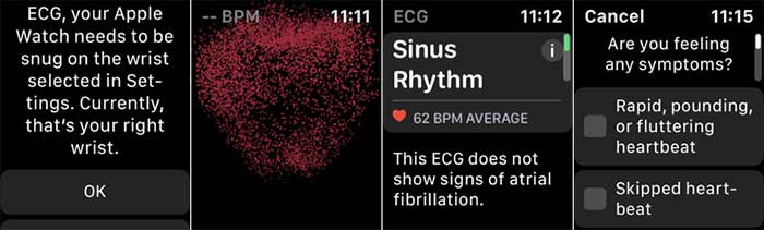 نظارت بر ecg در اپل واچ