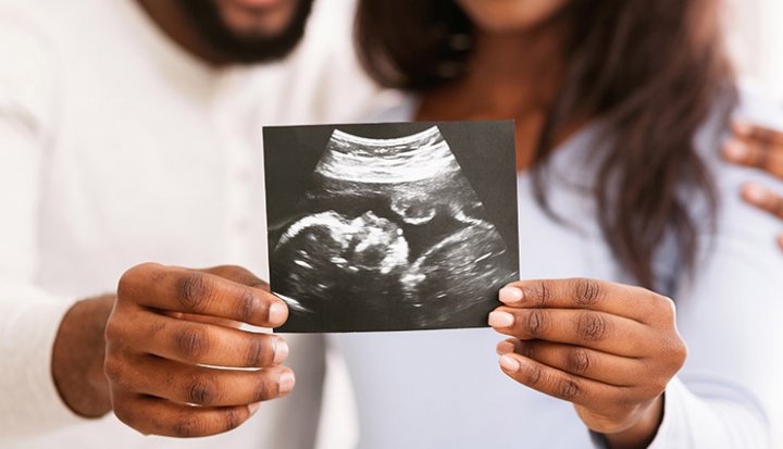 تصویر سونوگرافی در بارداری