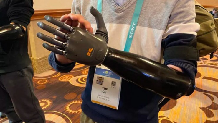 کنترل دست مصنوعی با ذهن؛ هوش مصنوعی به کمک معلولان می&zwnj;آید