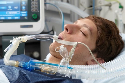دستگاه تنفس مصنوعی یا ونتیلاتور چیست و چگونه کار می‌کند؟