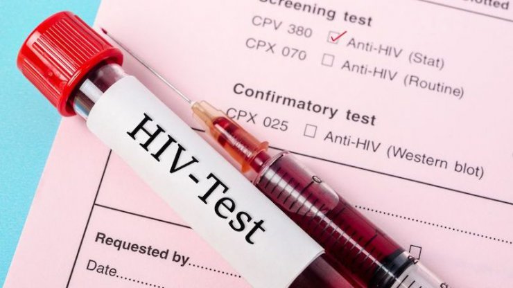 درمان احتمالی بیمار HIV بدون تزریق سلول های بنیادی