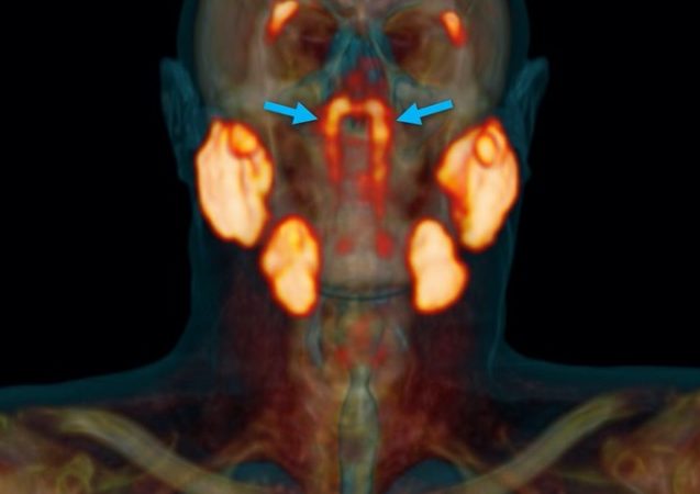 دانشمندان اندامی جدید را در گلو کشف کردند