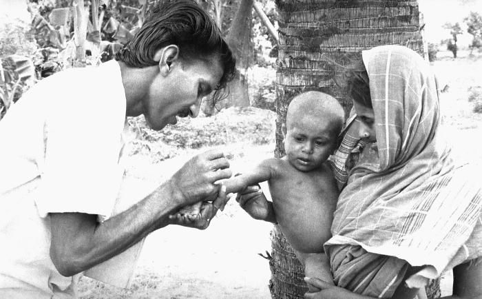 Image result for smallpox