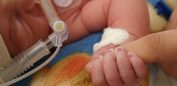 شناسایی نوزاد مبتلا به گونه جدید کرونا با حجم ویروسی ۵۱ هزار برابر بیماران عادی