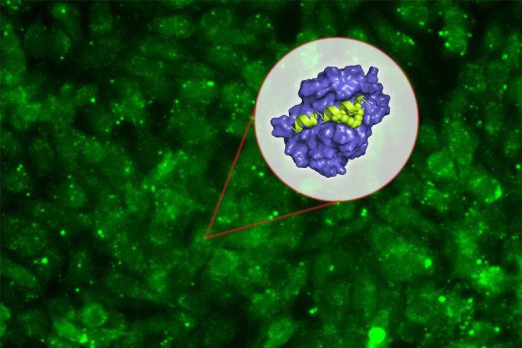 دانشمندان MIT: غشای اطراف سلول سرطانی می‌تواند نقش مهمی در کنترل متاستاز ایفا کند