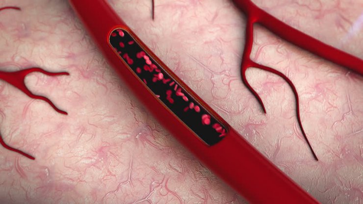 تحریک الکتریکی رگ‌ها می‌تواند به ترمیم سریع‌تر زخم‌ها کمک کند