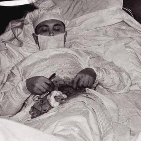 لئونید روگوزوف پزشکی است که خود را جراحی کرد