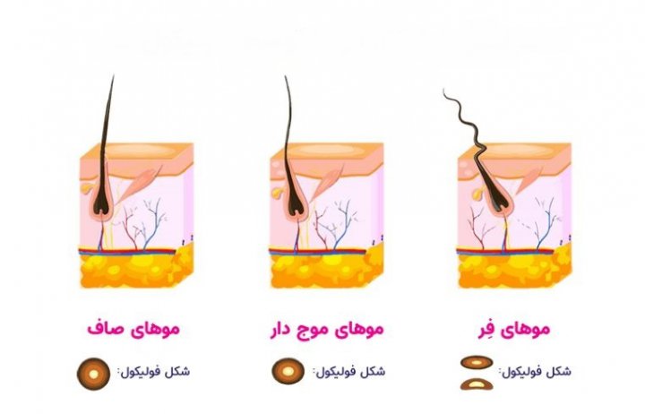 تعیین شکل مو