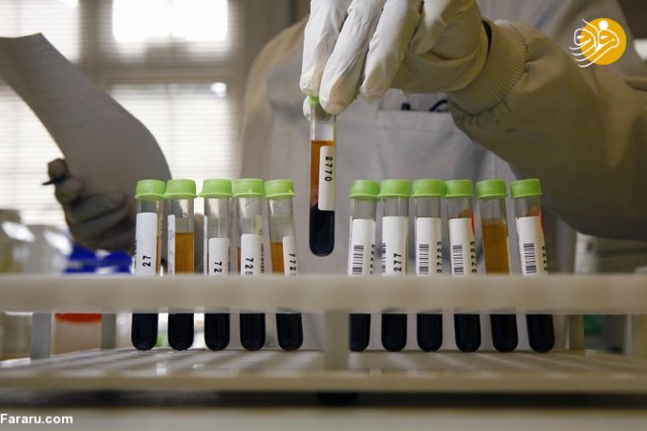 تست ESR خون چیست؟