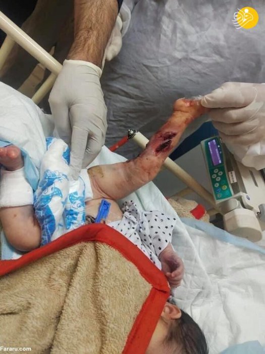 (تصاویر 16) داعش کودکان افغان را سلاخی کرد