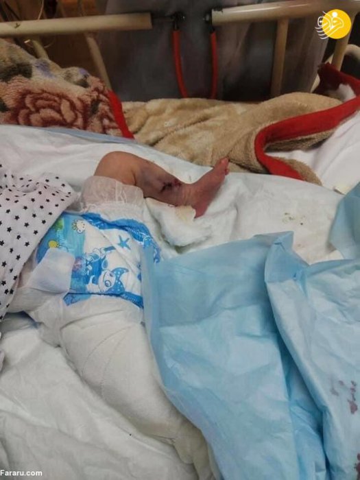 (تصاویر 16) داعش کودکان افغان را سلاخی کرد