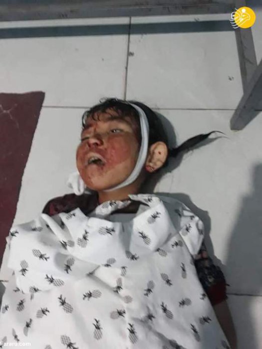 (تصاویر 16) داعش کودکان افغان را سلاخی کرد