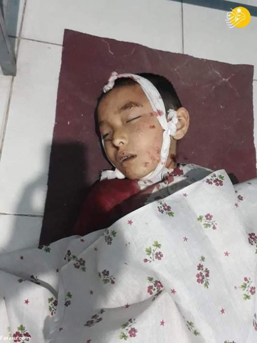 (تصاویر 16) داعش کودکان افغان را سلاخی کرد