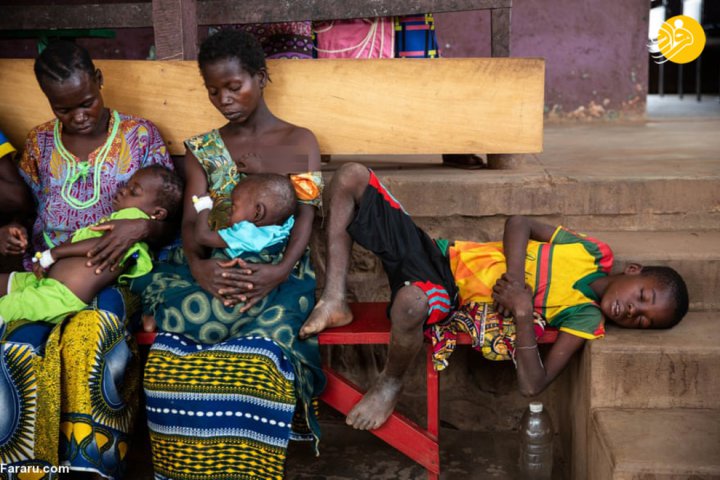 (تصاویر) سرخک؛ بلای جان کودکان آفریقای مرکزی