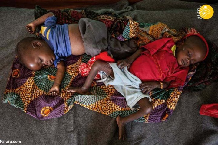(تصاویر) سرخک؛ بلای جان کودکان آفریقای مرکزی