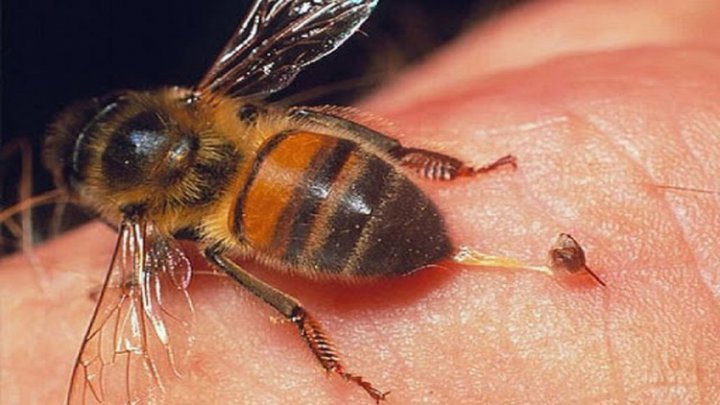 ماجرای درمان کرونا با زهر زنبور عسل