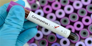 تست کرونا ۱۳۸۳ ایرانی در ۲۴ ساعت مثبت شد