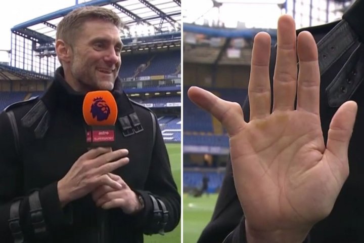 بلای عجیبی که بر سر گلر سابق چلسی آمده(عکس)