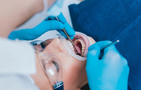 جراحی دندان شامل چه مواردی است؟ مراقبت بعد از جراحی