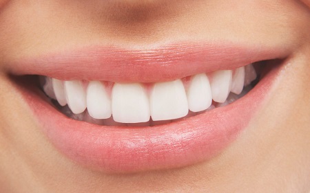 داشتن لبخند زیبت بت کمک ایمپلنت دندان جلو