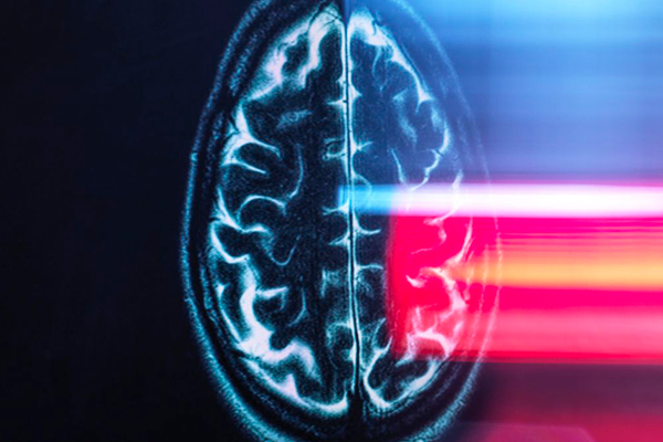 هوش مصنوعی آلزایمر را ۷ سال پیش از ظهور علائم بالینی پیش بینی می کند
