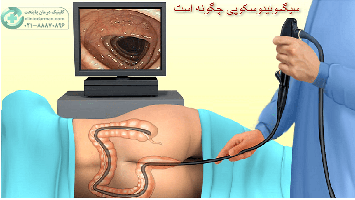 تفاوت سیگموئیدوسکوپی و کولونوسکوپی چیست