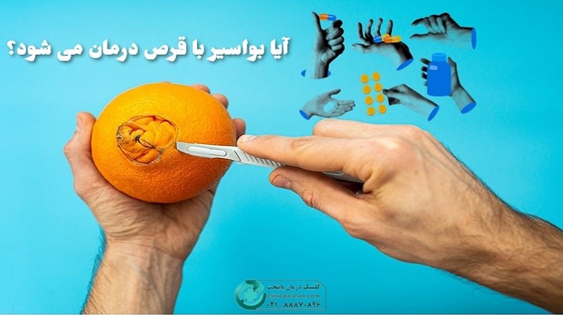 برای هموروئید چه قرصی بخوریم؟