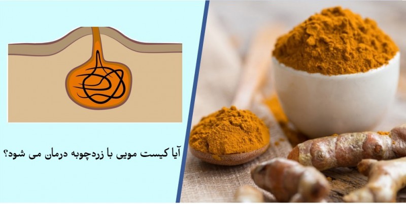 بهترین روش استفاده از زردچوبه برای کیست مویی چیست؟