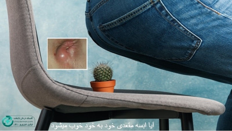 واقعیات پزشکی درباره آبسه مقعدی و احتمال بروز سرطان
