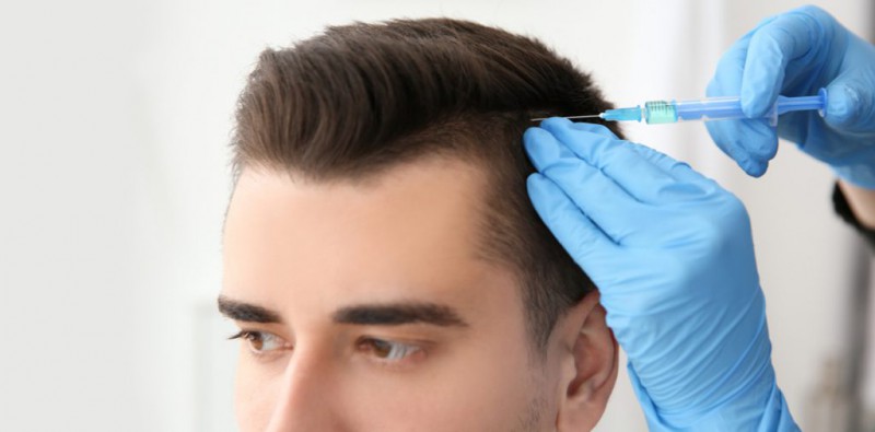 رشد مجدد مو با مزوتراپی: راهکاری موثر برای مبارزه با ریزش مو