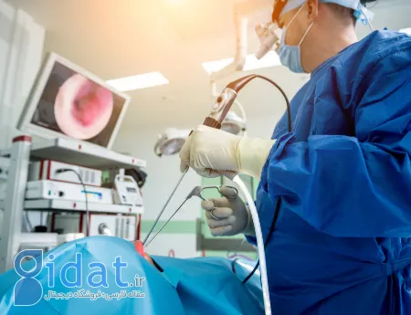 هموروئیدکتومی چیست, مدت زمان بهبودی هموروئیدکتومی