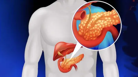 علائم سرطان پانکراس در پاها, درد پا و سرطان پانکراس