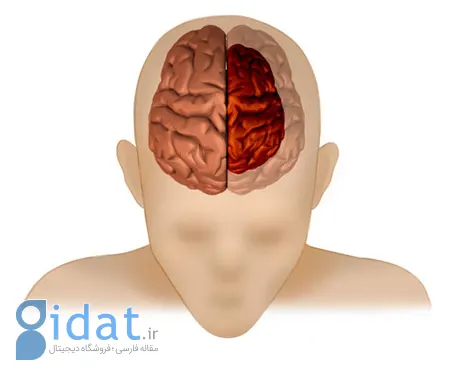 آتروفی مغز چیست و چه تاثیری بر زندگی ما دارد؟