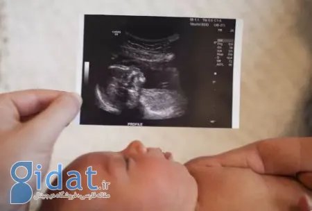 تفاوت جنین پسر و دختر در سونوگرافی