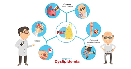 دیس لیپیدمی, علائم دیس لیپیدمی,راههای تشخیص بیماری دیس لیپیدمی