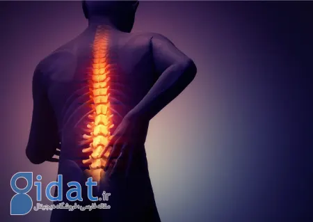 اسپوندیلوآرتریت محوری چیست, تشخیص اسپوندیلوآرتریت