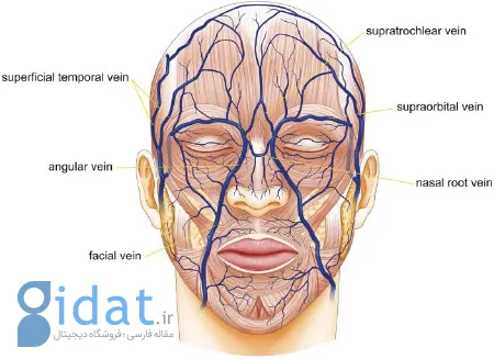 بیرون زدگی رگ پیشانی, بیرون زدگی رگ شقیقه