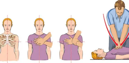 زمان انجام احیای قلبی ریوی, زمان انجام CPR